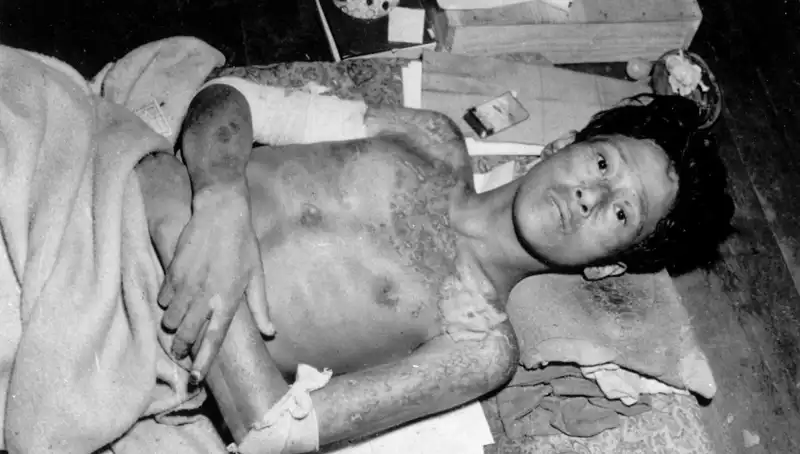 80 Yıl Sonra Nagasaki’den Uyarı: Nükleer Felaket Tehdidi Büyüyor
